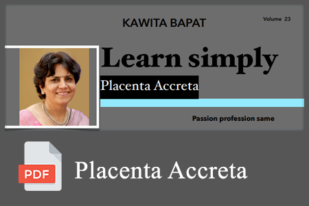 Placenta Accreta